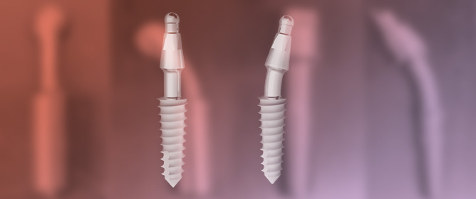 Effect of Plastic Deformation-Induced Residual Stress on the Corrosion Behavior of Monoblock Dental Implants: Implications for Clinical Performance