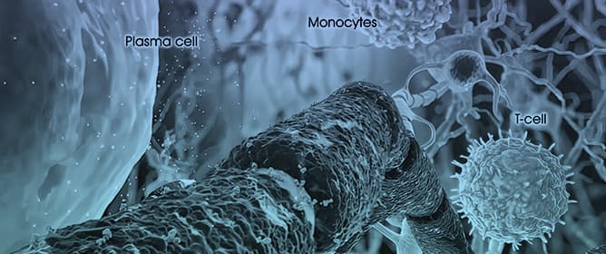 Navigating the Therapeutic Landscape of Multiple Myeloma: Immunotherapy, Microenvironment, and Resistance
