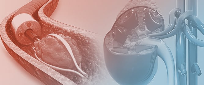 Safety Profile of Suction-Assisted RIRS: A Prospective Analysis of Intraoperative Anesthetic Events