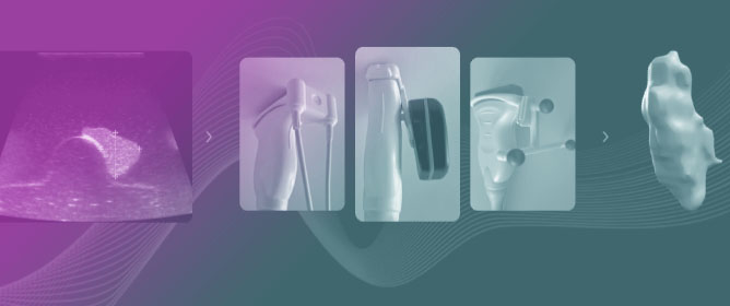 Tomographic 3D Ultrasound for Thyroid Volumetry&mdash;A Comparison Between Multiplanar 2D and 3D Imaging Methods