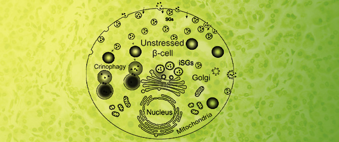 Crinophagy in Pancreatic Beta Cells: From Insulin Granule Turnover to Diabetes Pathogenesis