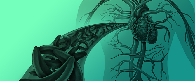 Lipoprotein(a) in Personalized Cardiovascular Prevention: Risk Stratification, Coronary Artery Calcium, and Emerging Lp(a)-Lowering Therapies