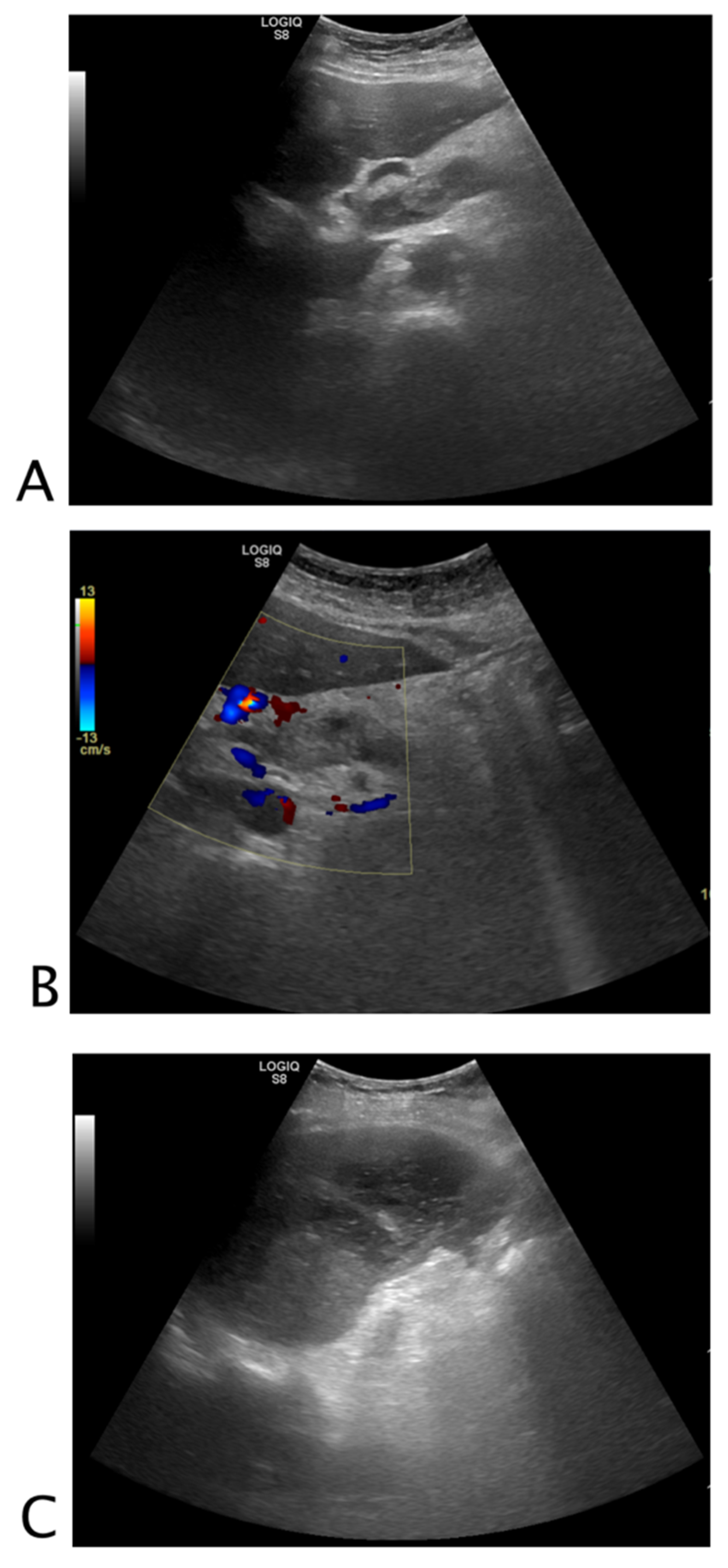Tomography | Free Full-Text | The &ldquo;Black a Simplified Ultrasound Approach Non-Traumatic Abdominal
