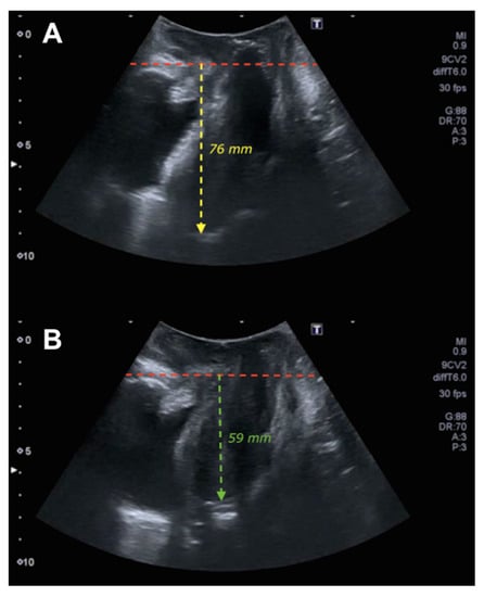 Tomography Free Full Text Predictive Model For The Diagnosis Of