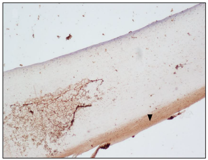 PDF] Microscopic examination of normal nail clippings. | Semantic Scholar