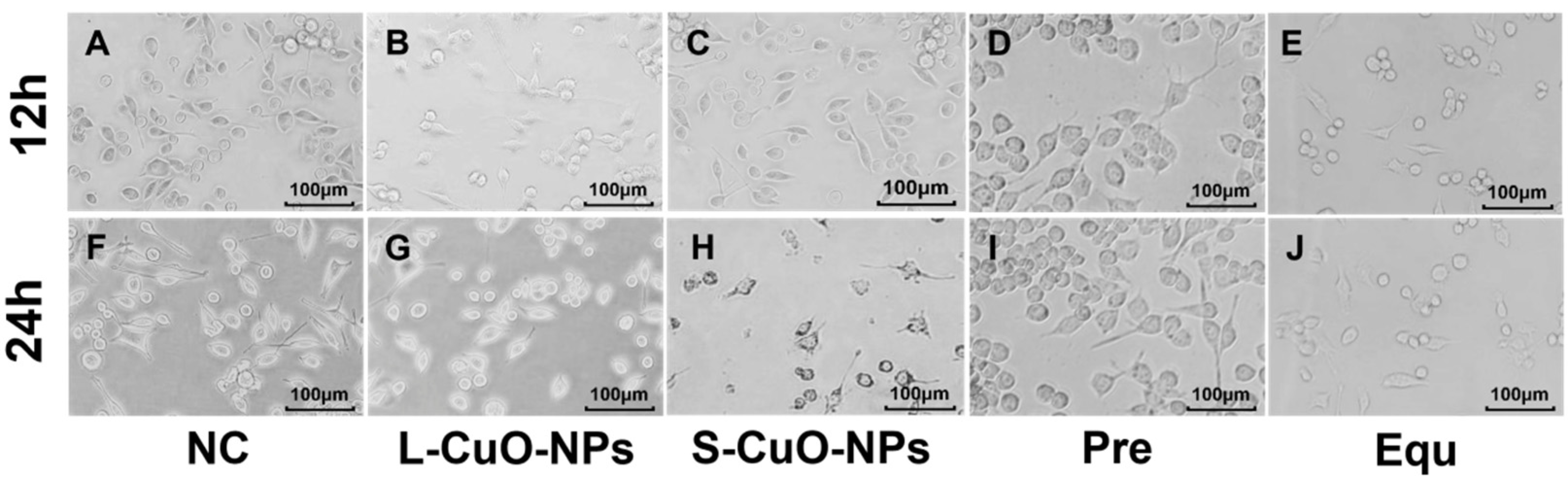 Cuo-nps Induce Apoptosis And Functional Impairment In Bv2 Cells Through 