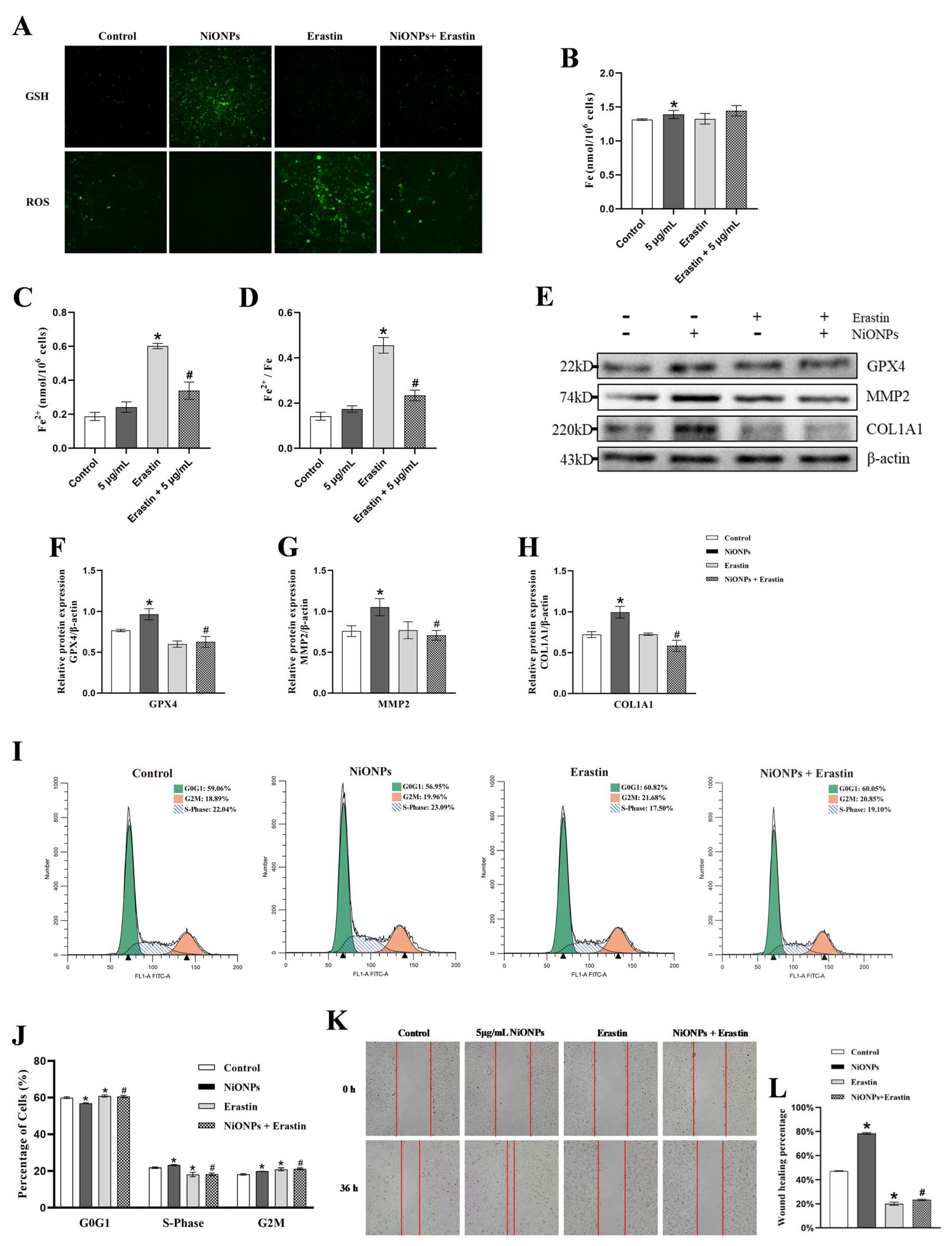 本格派ま！ Regulates Hsa_circ_0001944 FXR/TLR4 Ferroptosis and Pathway 邦楽