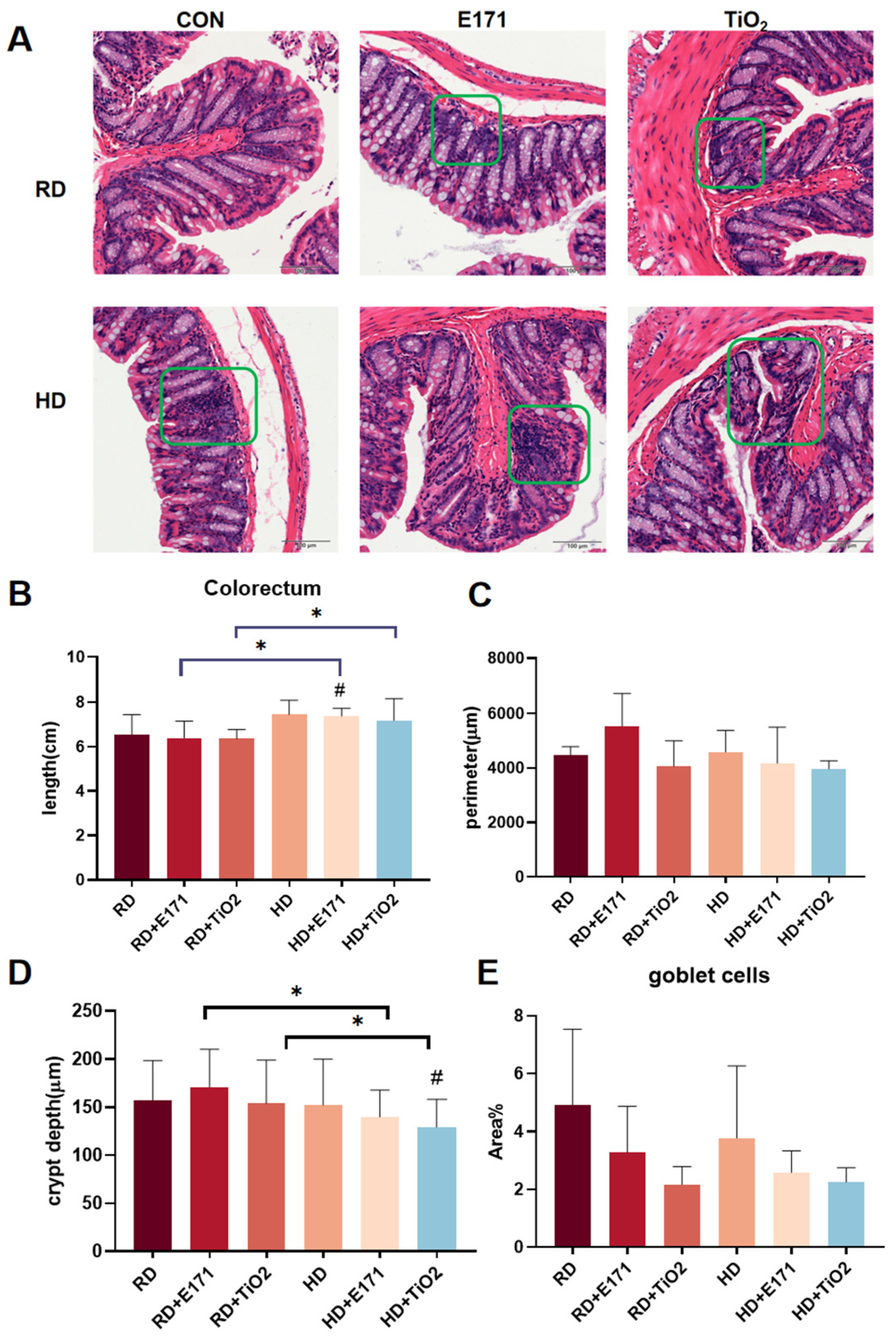 Tio2 Digestion Co-Exposure to Food-Grade and Nano-TiO2 with High-Fat Diet Induces ...