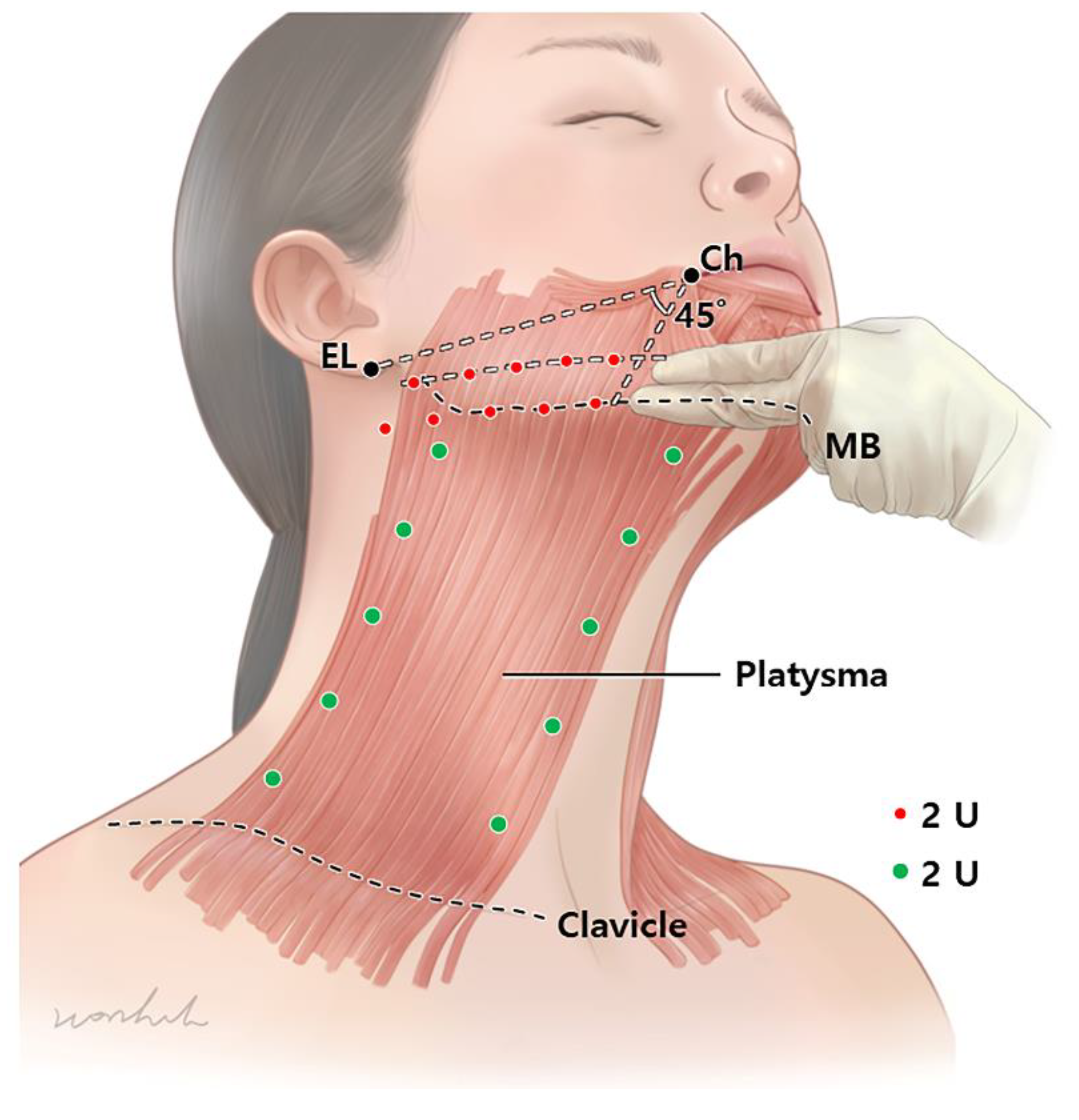 Platysma Platysma