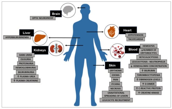 Toxins | Free Full-Text | Systemic Loxoscelism, Less Frequent but More ...