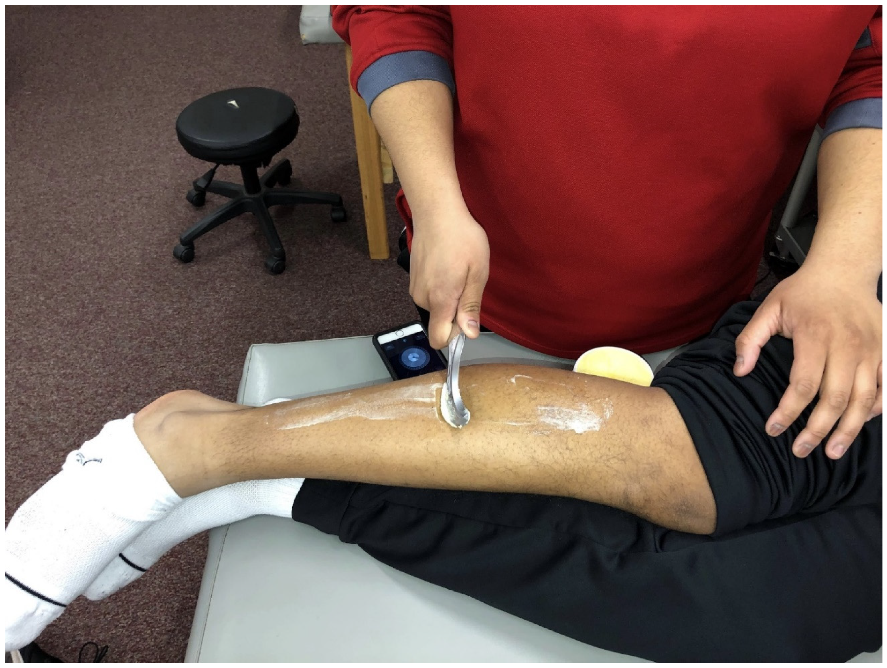 IASTM Treatment Protocol for an Inversion Ankle Sprain
