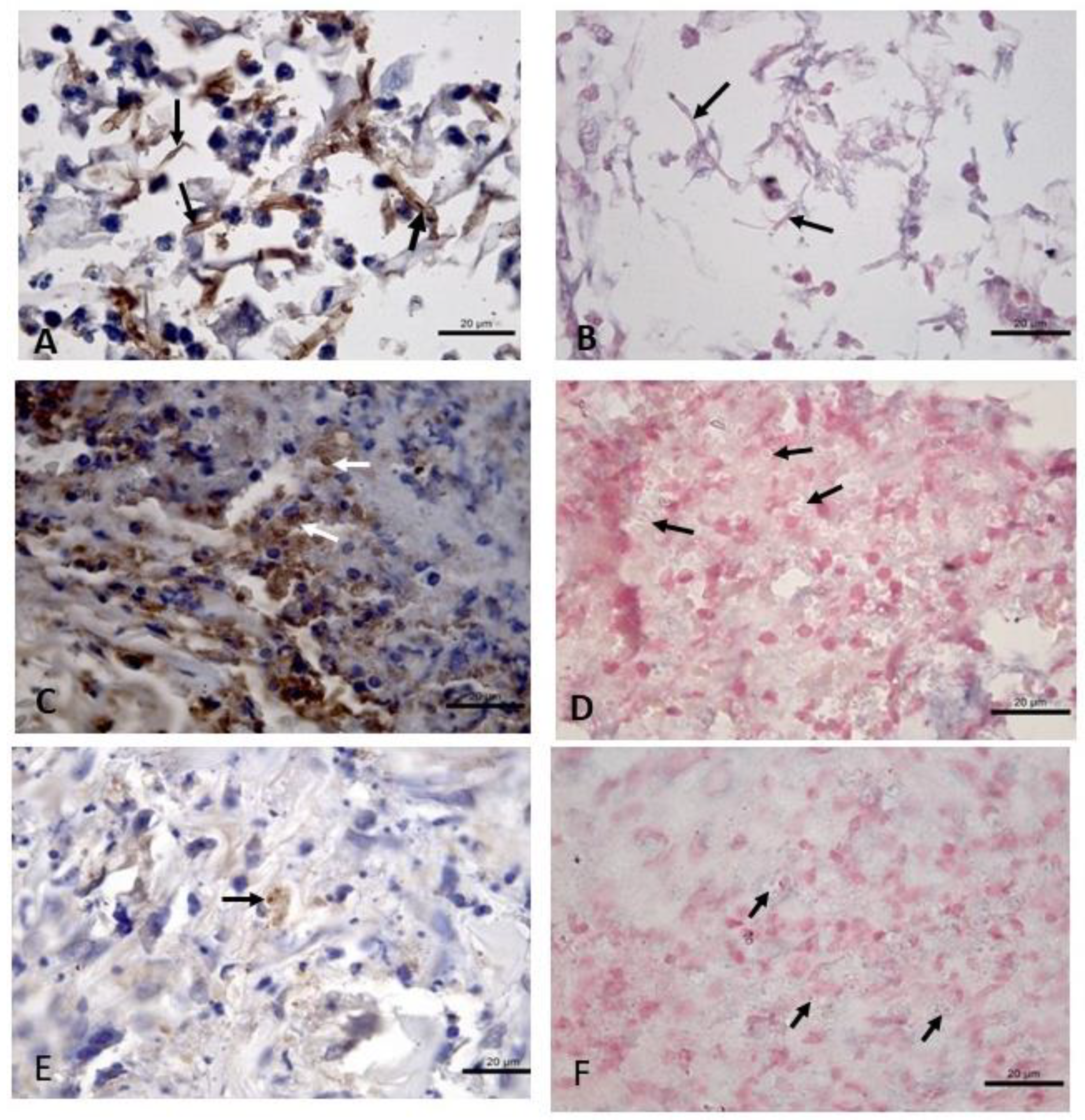 visceral leishmaniasis histology