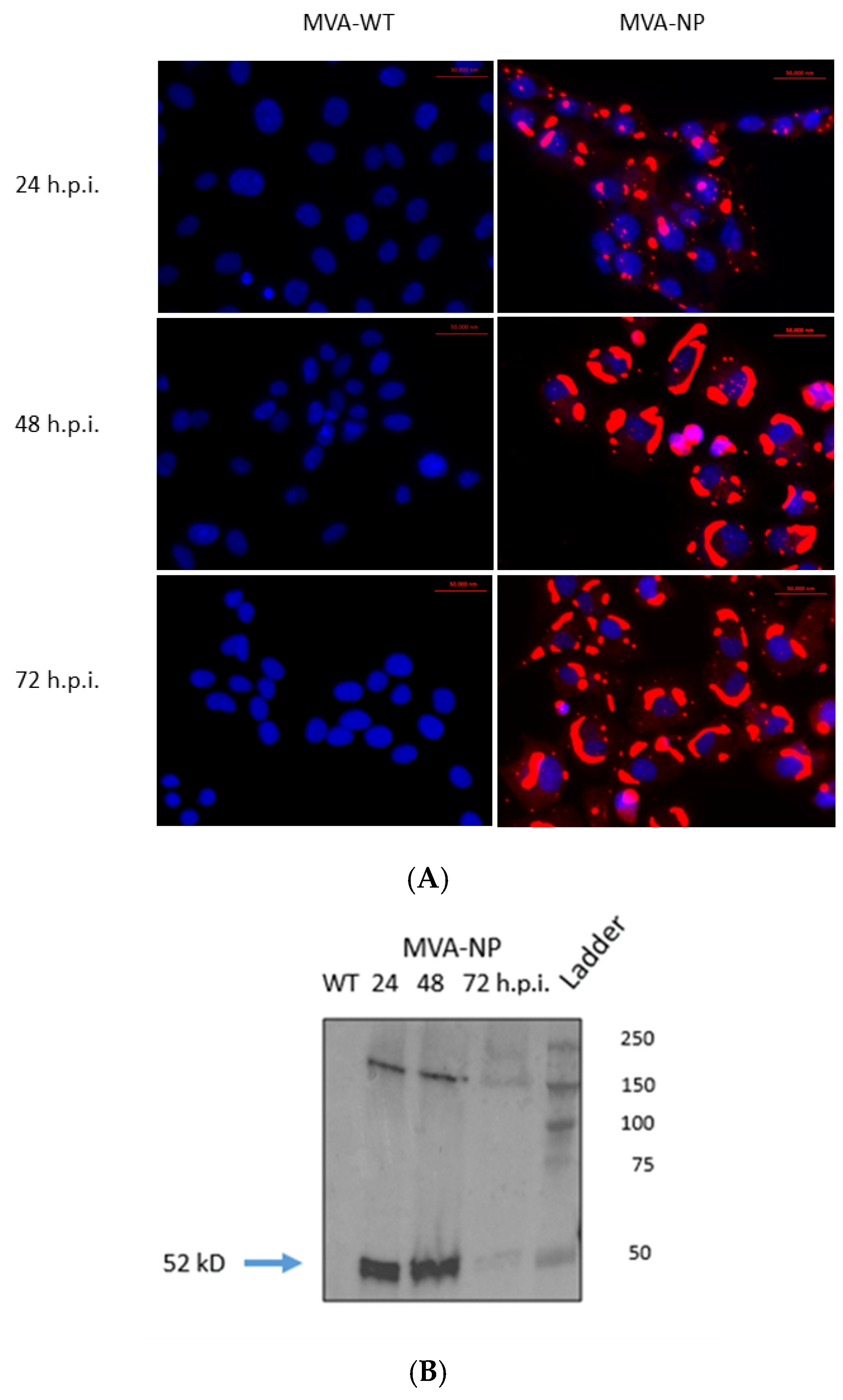 Prime-Boost Vaccination Based on Nanospheres and MVA Encoding the ...