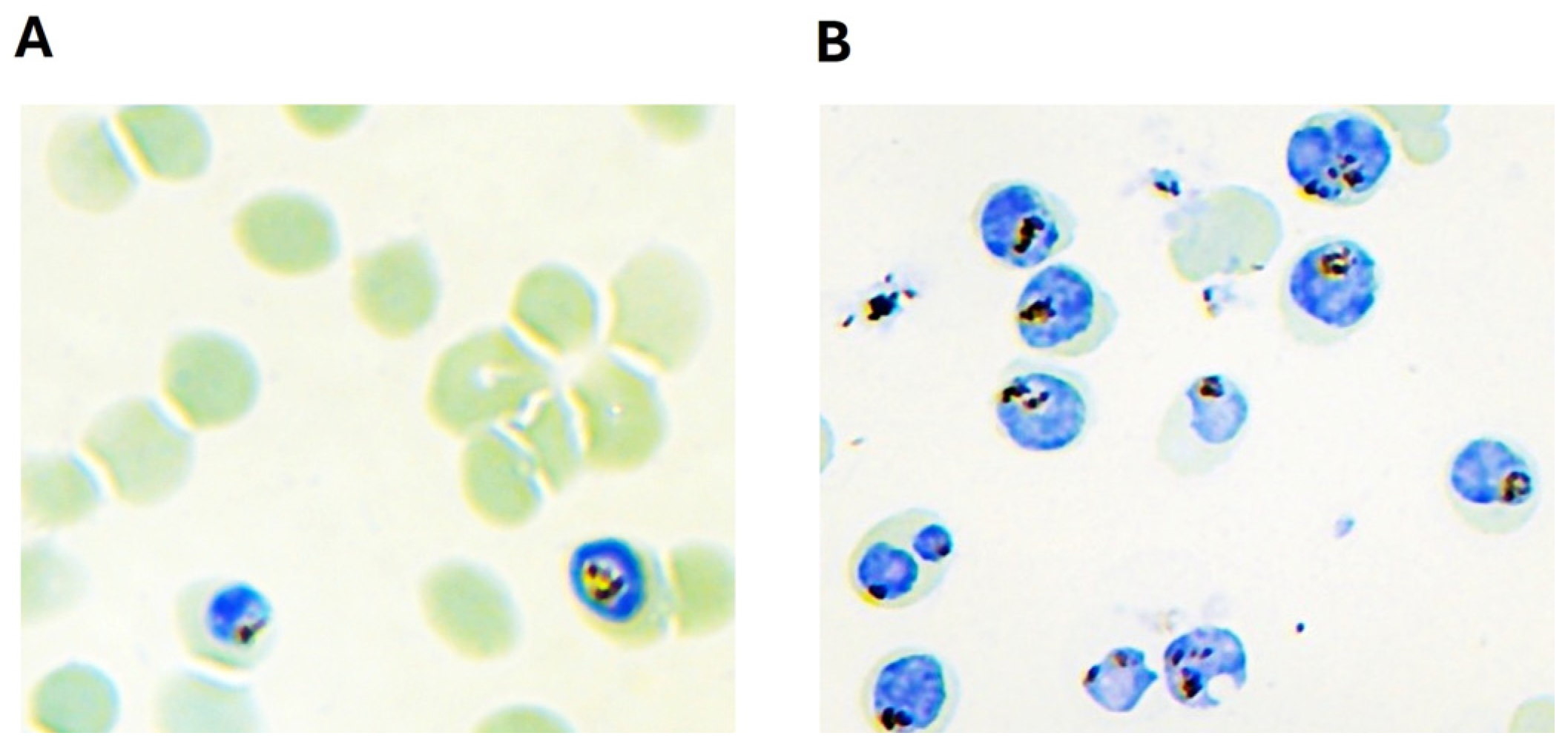 Identification of Novel Malaria Antigens Expressed on the Surface of ...
