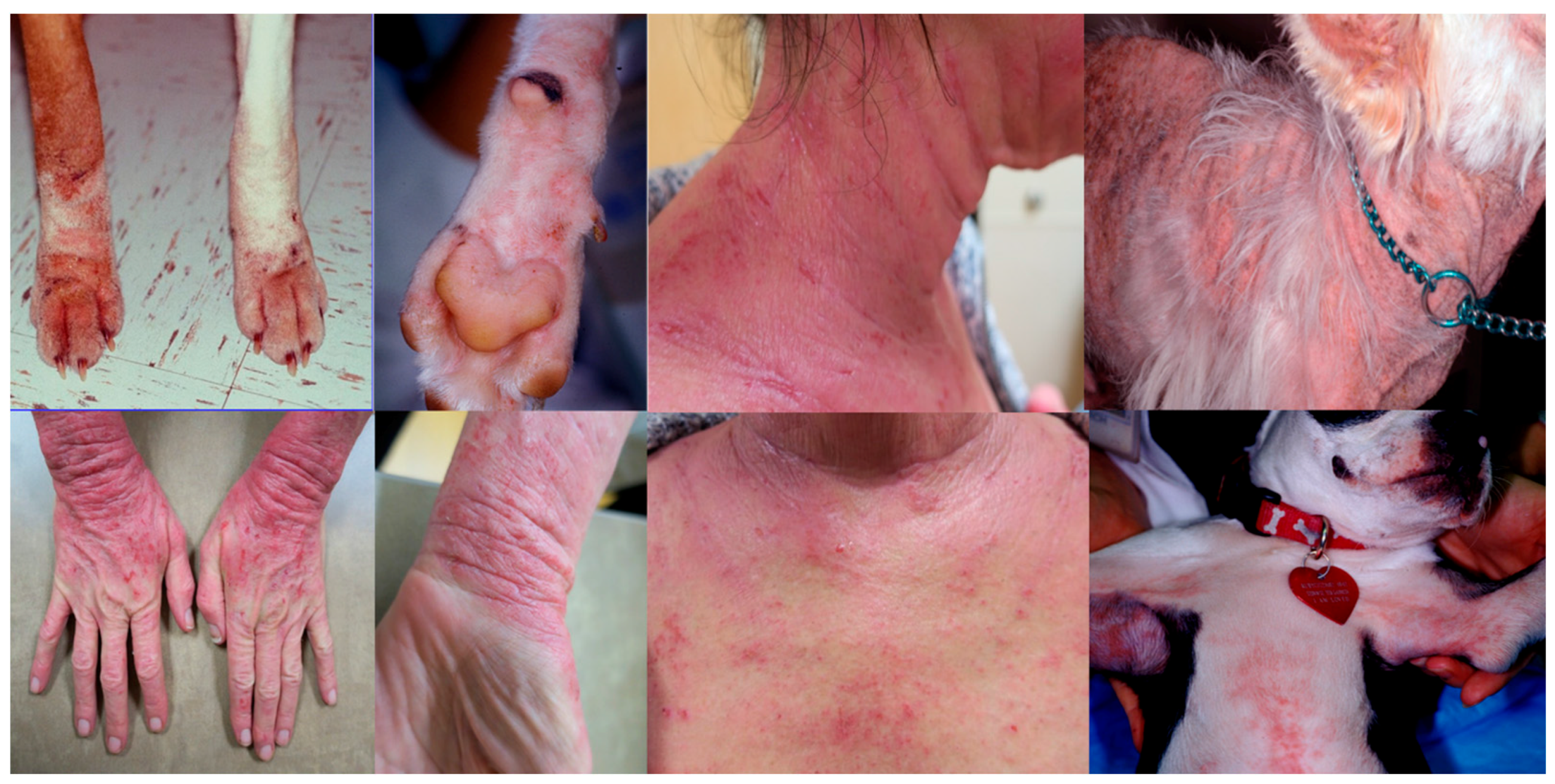 flea allergy dermatitis on humans