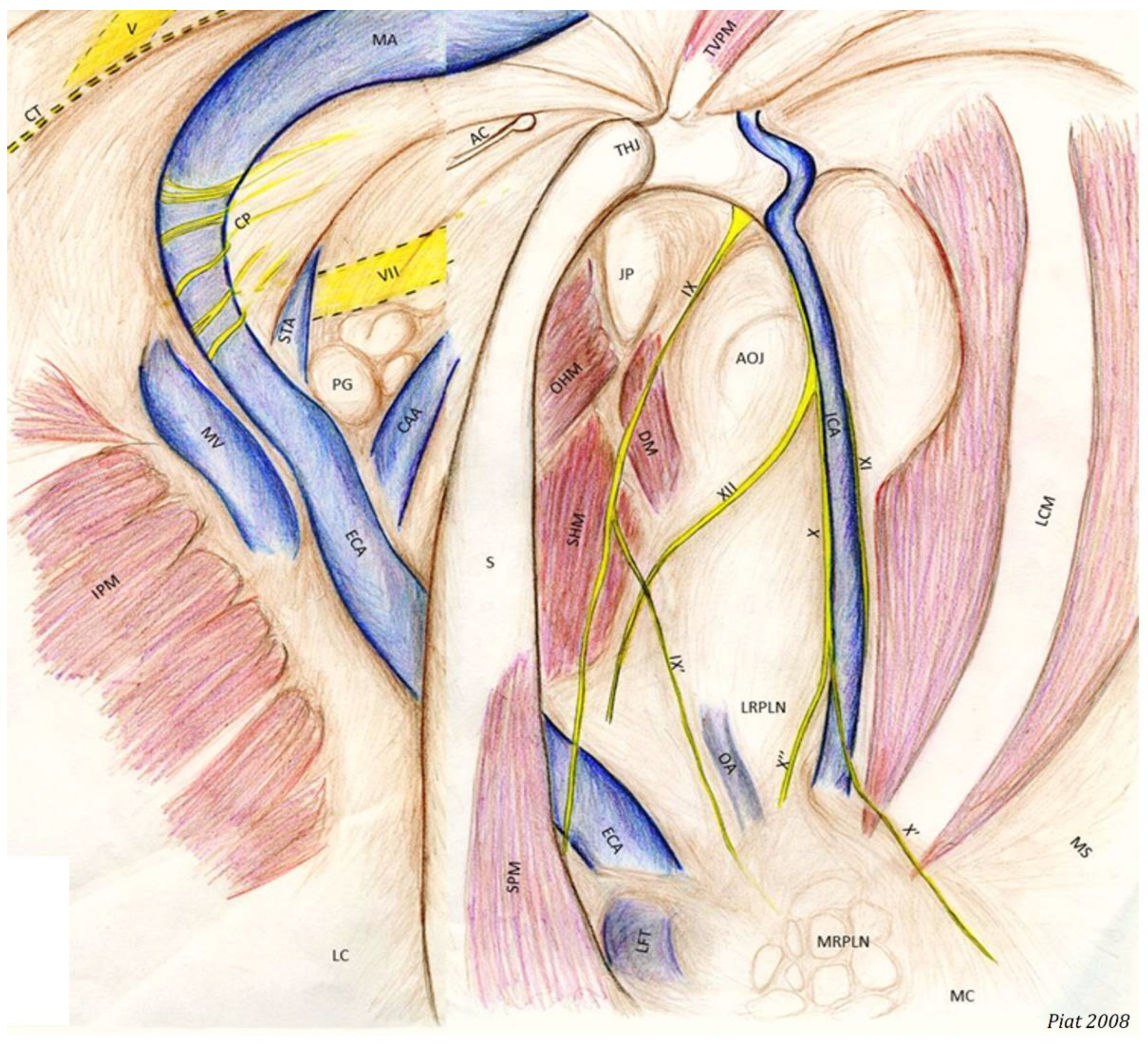 Mandibular nerve (CN V3), Encyclopedia, , Learn anatomy