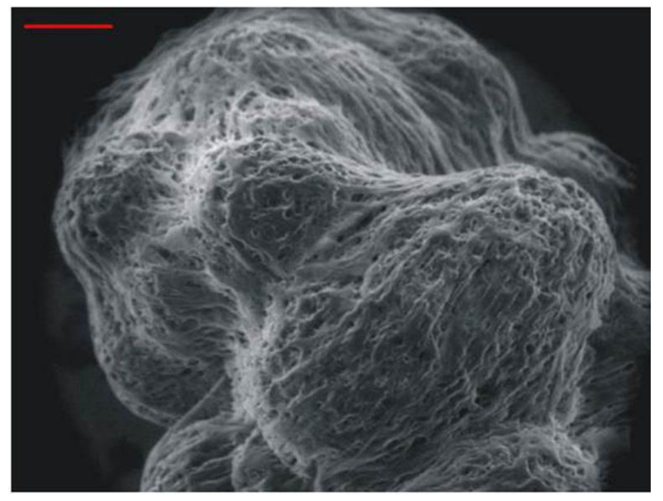 Varicella Zoster Virus VZV Human Neuron Interaction Varicella Zoster Virus VZV Human Neuron Interaction