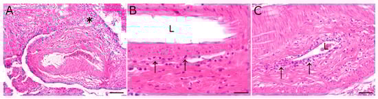 Evidence for a Novel Gammaherpesvirus as the Putative Agent of