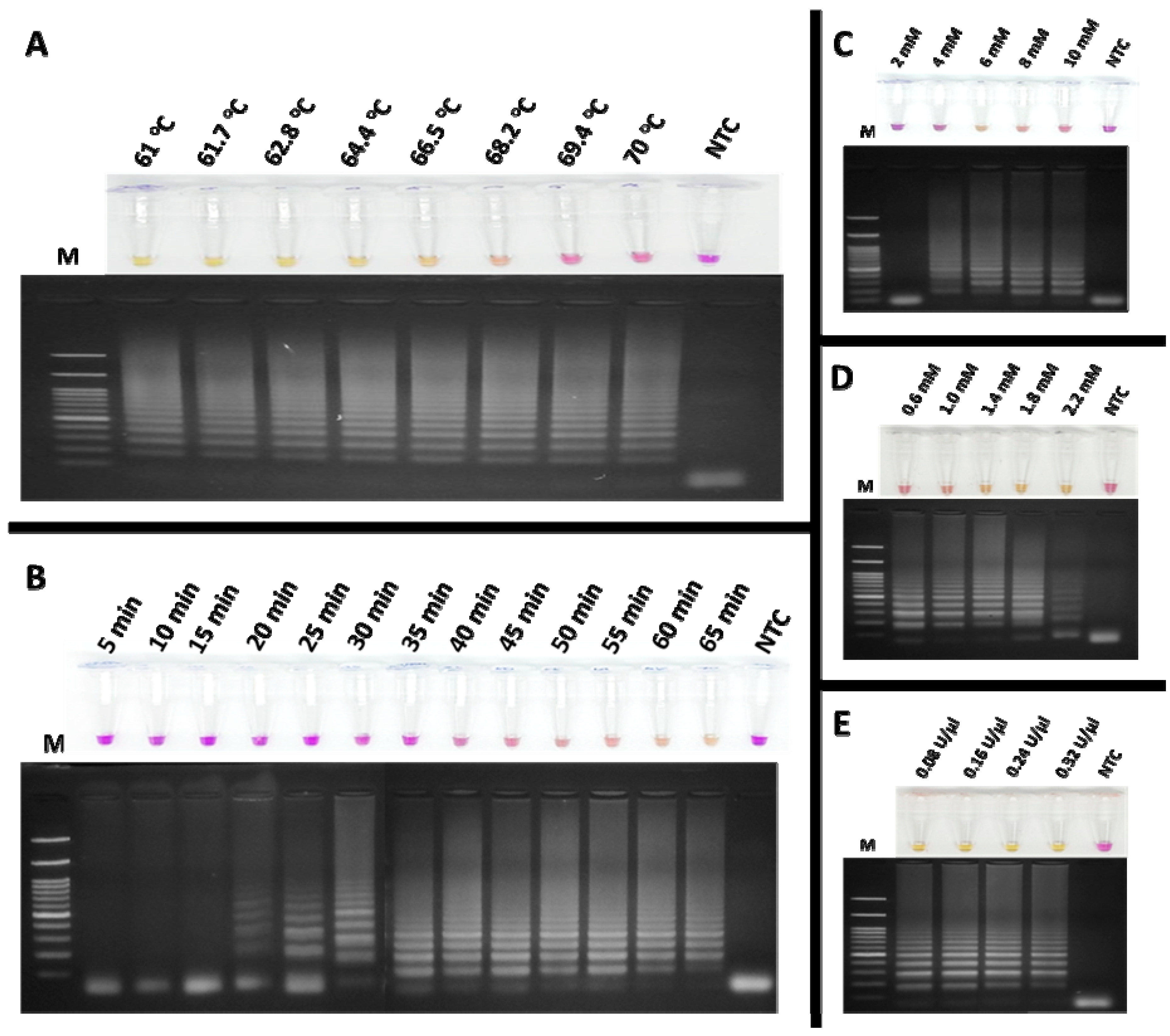 Colorimetric Reverse Transcription Loop-Mediated Isothermal ...