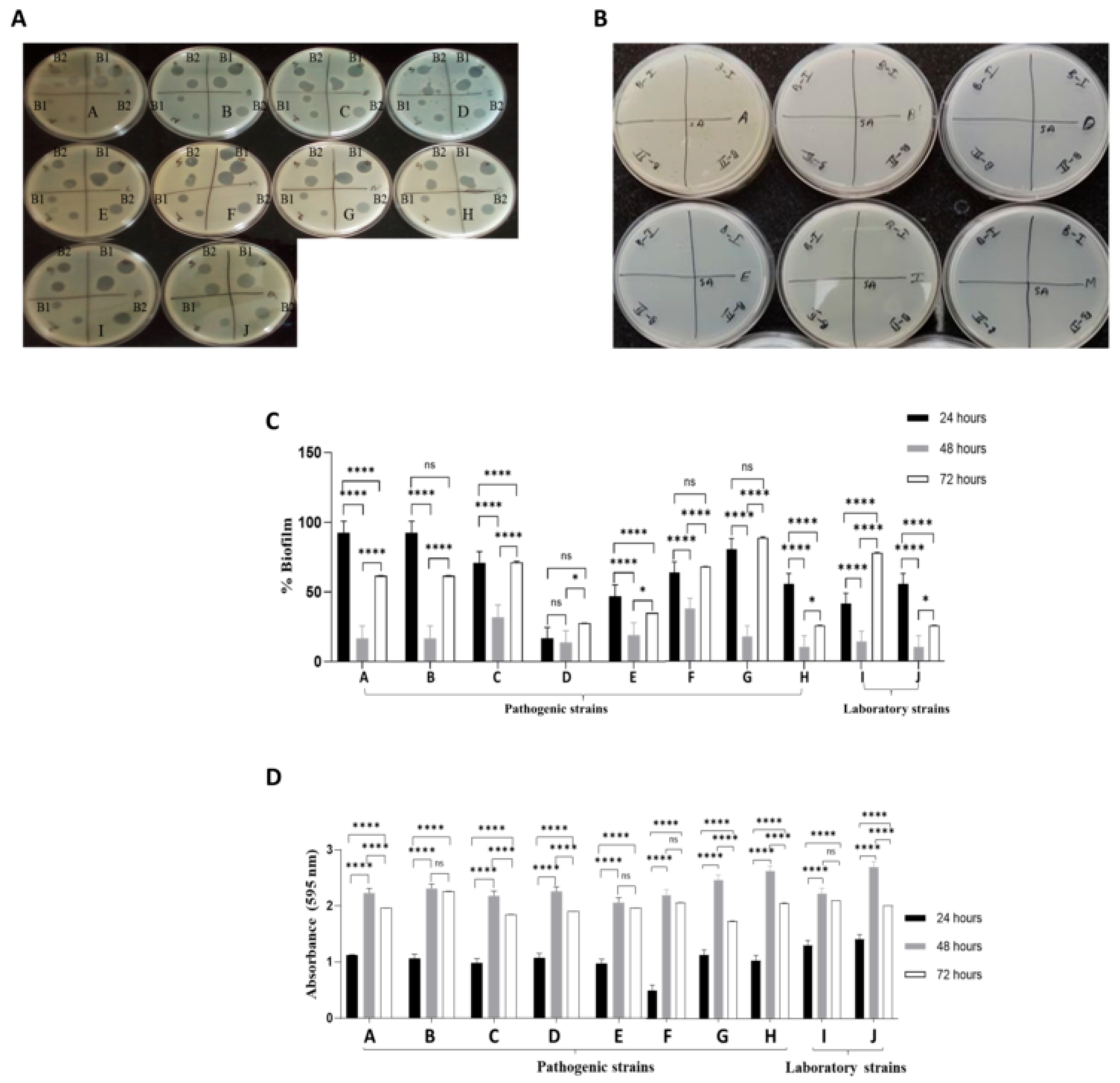 Isolation and Genomic Characterization of a Lytic Bacteriophage Against ...