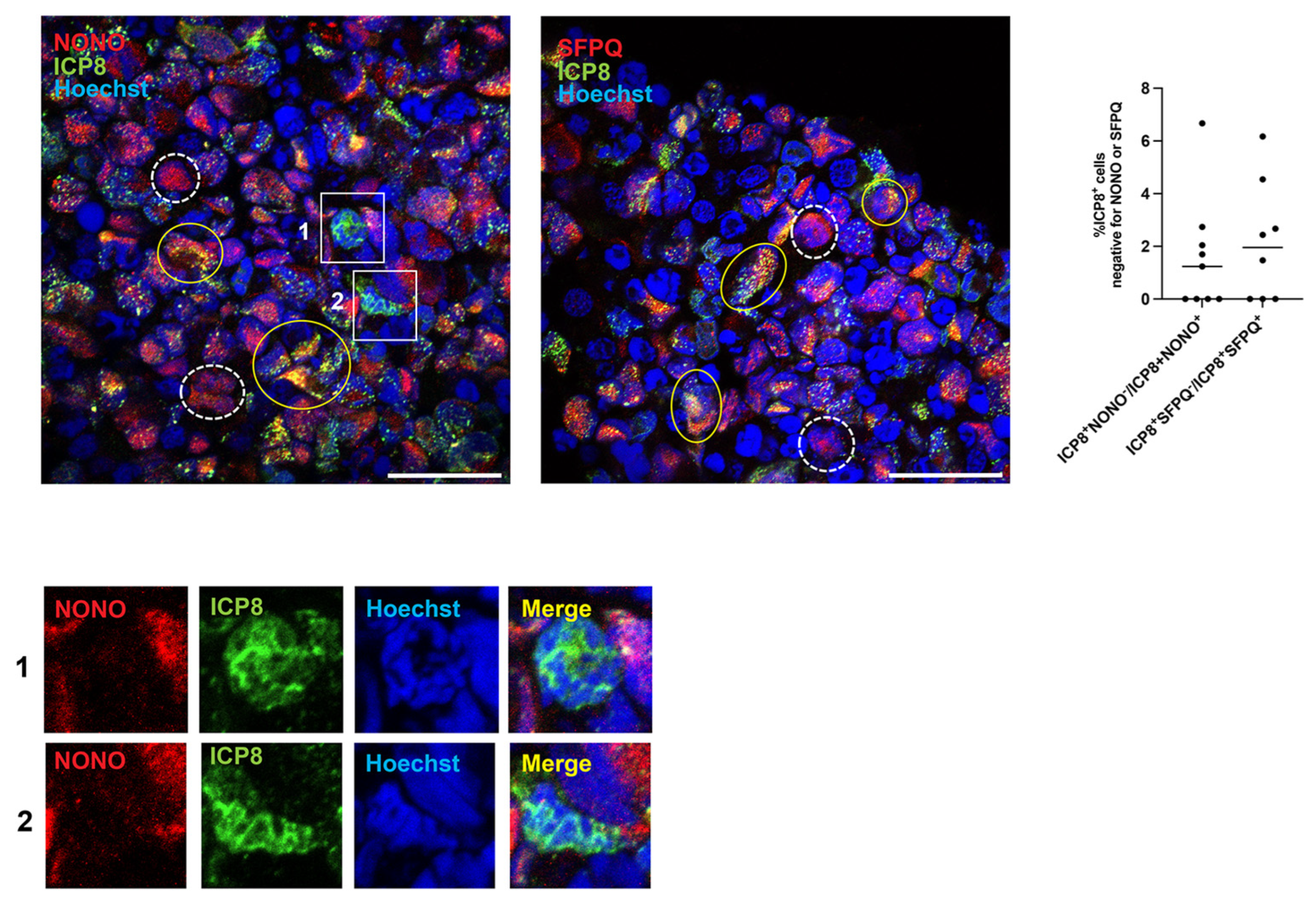 Dynamics of Paraspeckle Components in Herpes Simplex Virus 1 (HSV-1 ...