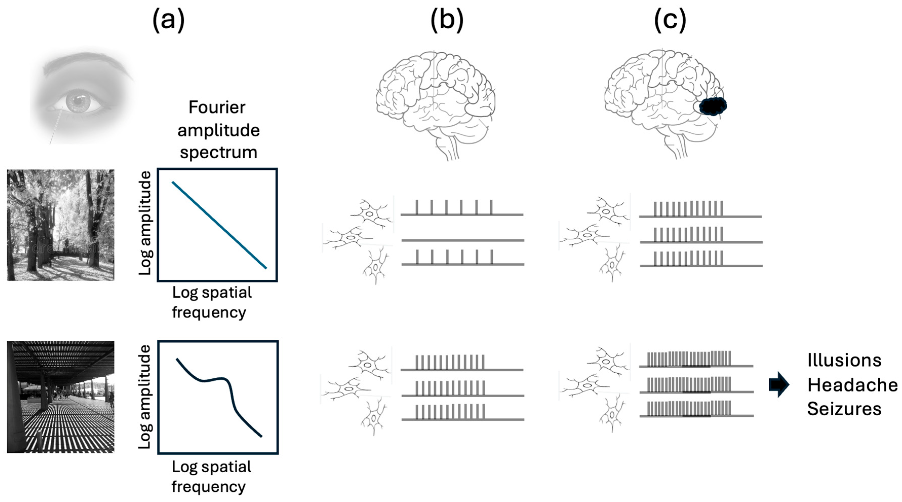 Visual Stess A Cerebral Basis for Visual Discomfort and Visual Stress