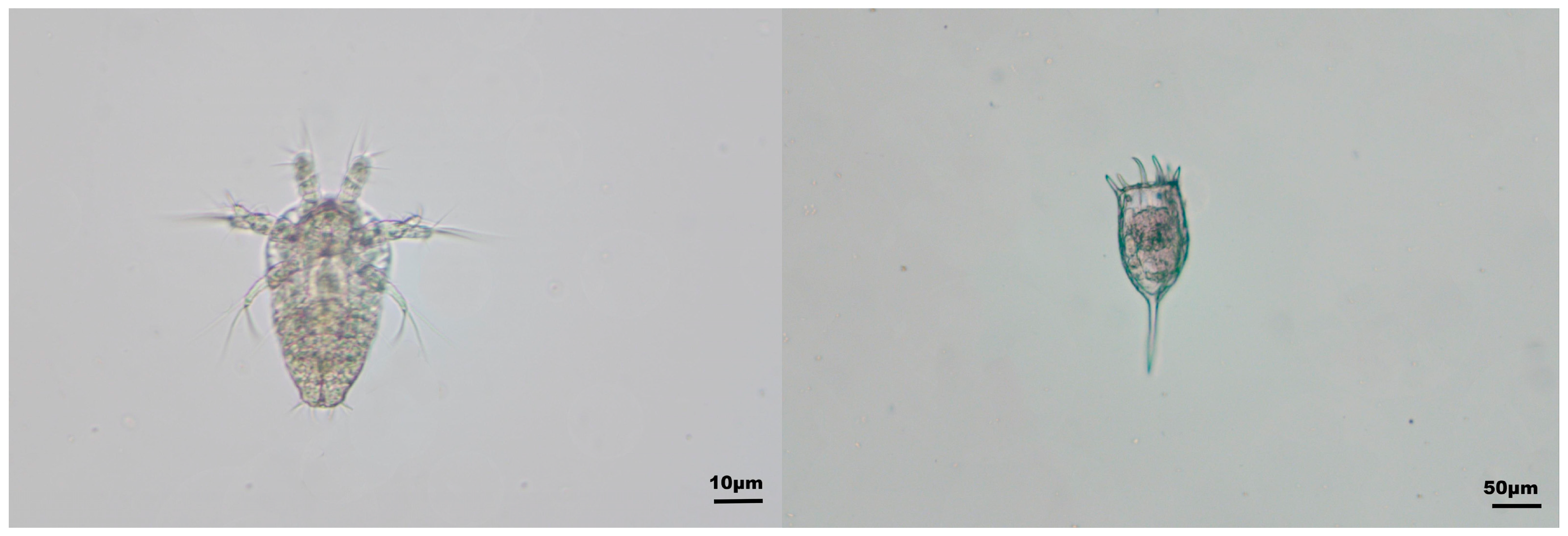 Spatial And Seasonal Dynamics Of Plankton Community And Its 